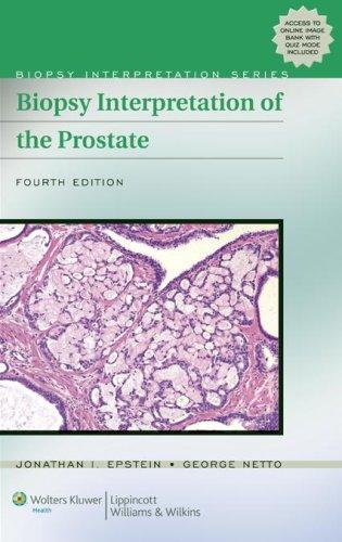 Biopsy Interpretation of the Prostate