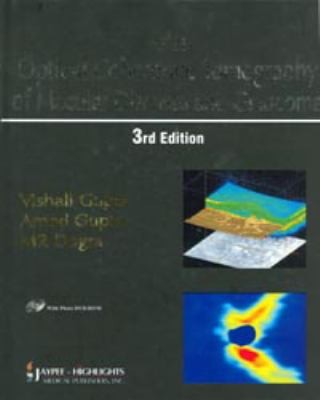 Atlas, optical coherence tomography of macular diseases and glaucoma