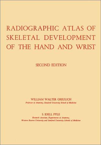 Radiographic Atlas of Skeletal Development of the Hand and Wrist