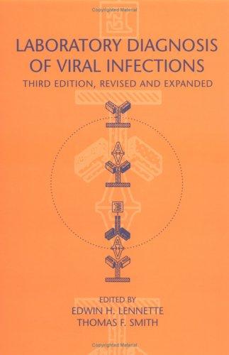 Laboratory Diagnosis of Viral Infections