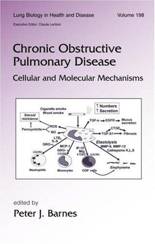 Chronic obstructive pulmonary disease