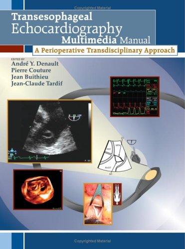 Transesophageal Echocardiography