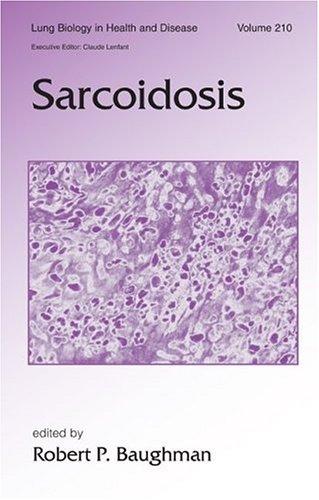 Sarcoidosis