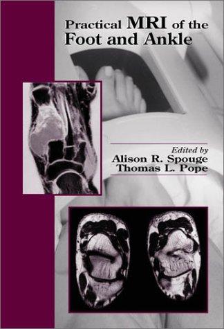 Practical MRI of the foot and ankle