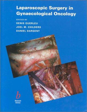Laparoscopic Surgery in Gynaecological Oncology