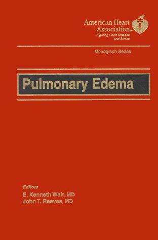 Pulmonary edema
