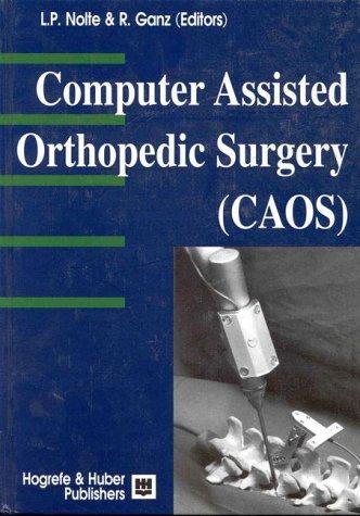Computer Assisted Orthopedic Surgery (CAOS)