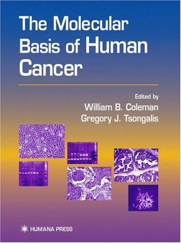 The Molecular Basis of Human Cancer