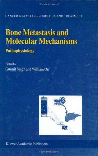 Bone Metastasis and Molecular Mechanisms