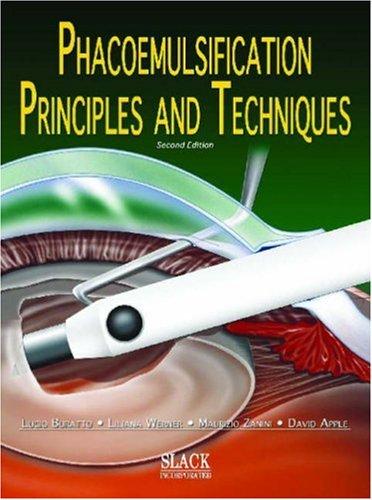 Phacoemulsification