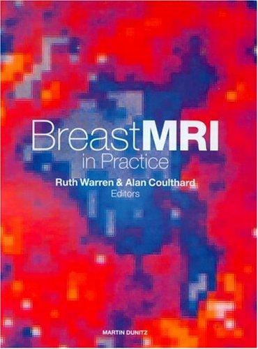 Breast MRI in Practice