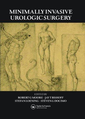 Minimally Invasive Urologic Surgery