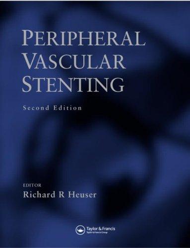 Peripheral vascular stenting