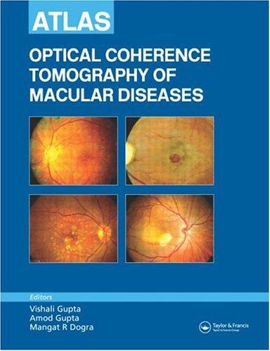 ATLAS: OPTICAL COHERENCE TOMOGRAPHY OF MACULAR DISEASES
