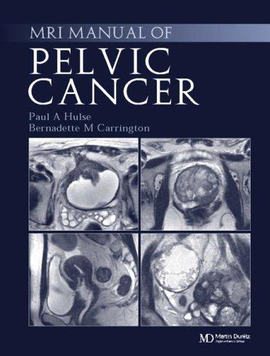 MRI Manual of Pelvic Cancer