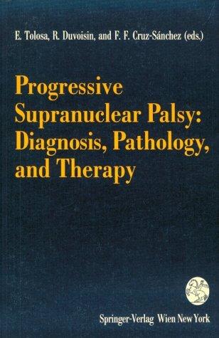 Progressive supranuclear palsy