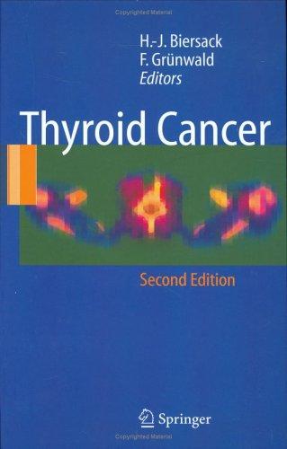 Thyroid Cancer