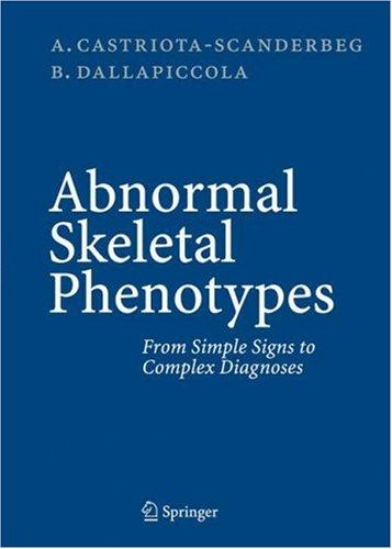 Abnormal Skeletal Phenotypes