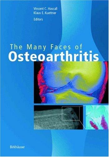 The Many Faces of Osteoarthritis