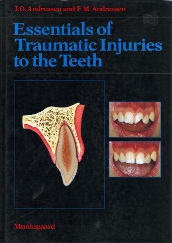 Essentials of Traumatic Injuries to the Teeth