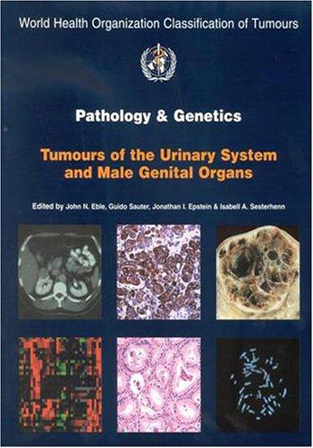 Pathology and Genetics of Tumours of the Urinary System and Male Genital Organs