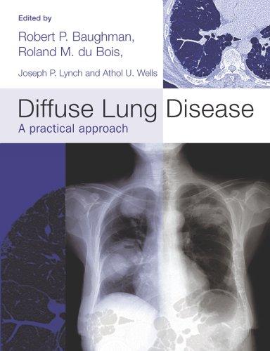 DIFFUSE LUNG DISEASE: A PRACTICAL APPROACH; ED. BY ROBERT P. BAUGHMAN