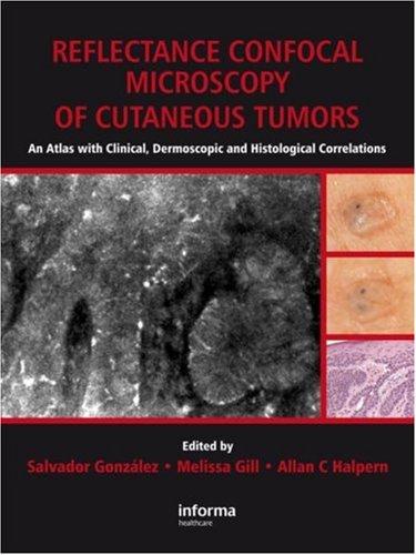 Reflectance Confocal Microscopy of Cutaneous Tumors
