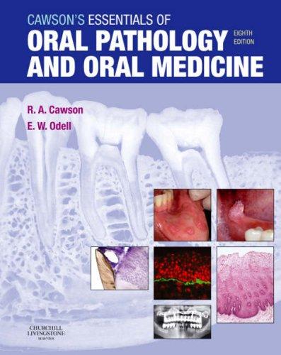 Cawson's essentials of oral pathology and oral medicine