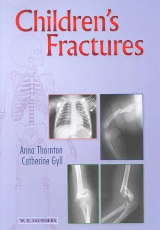 Children's Fractures