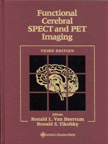 Functional Cerebral SPECT and PET Imaging