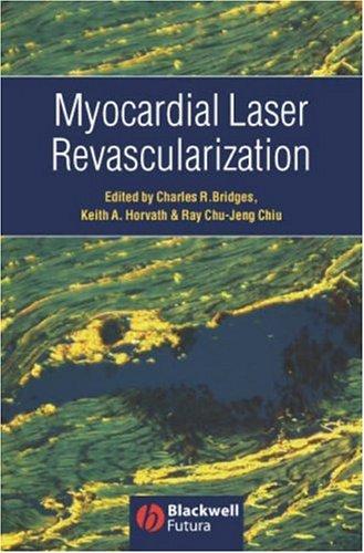 Myocardial laser revascularization