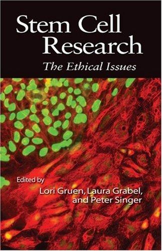 Stem cell research