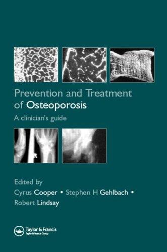 Prevention and treatment of osteoporosis