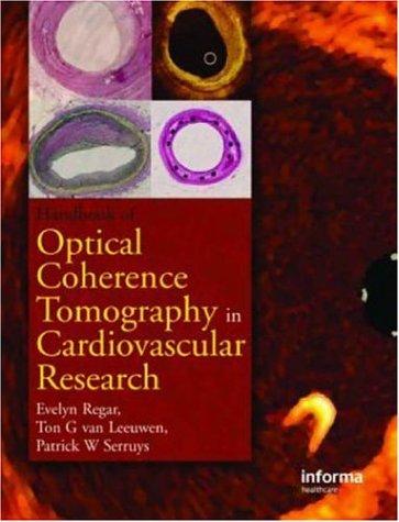 Optical coherence tomography in cardiovascular research