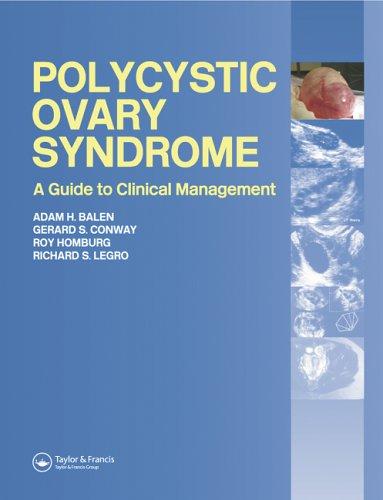 Polycystic Ovary Syndrome