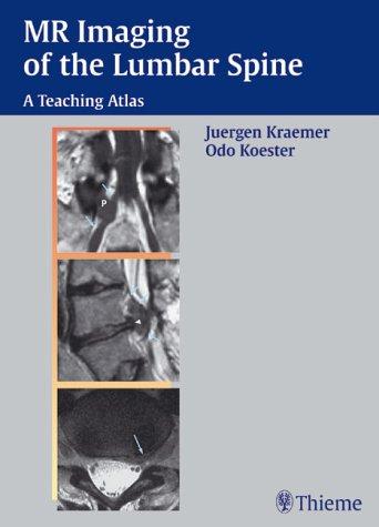 MRI of the Lumbar Spine