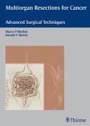Multiorgan Resections for Cancer