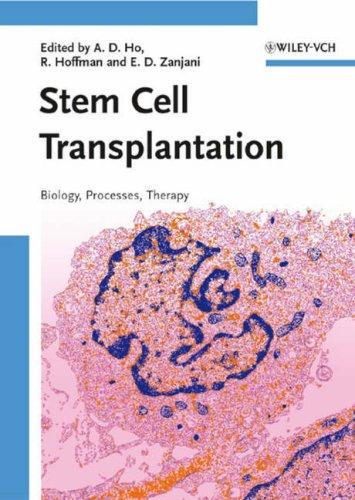 Stem cell transplantation