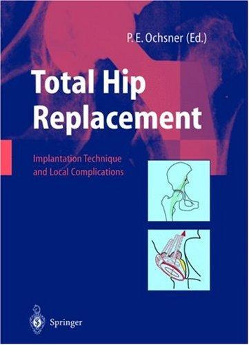 Total Hip Replacement