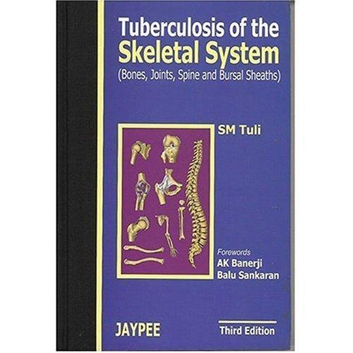 Tuberculosis of the Skeletal System