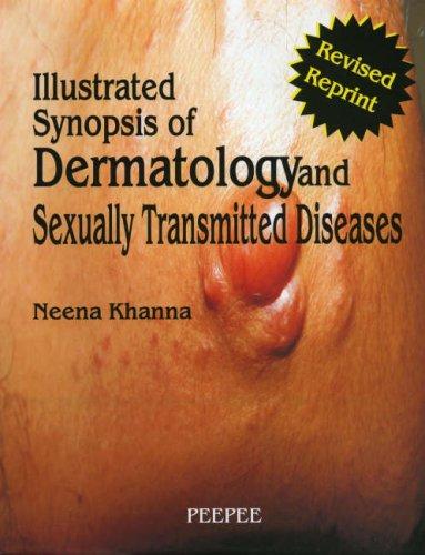 Illustrated Synopsis of Dermatology and Sexually Transmitted Diseases