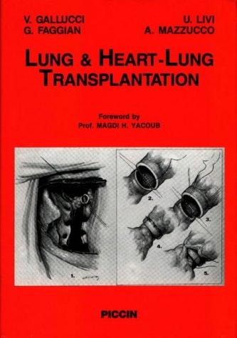 Lung & Heart Transplantation