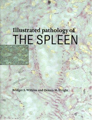 Illustrated pathology of the spleen
