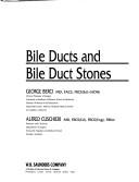 Bile ducts and bile duct stones