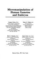 Micromanipulation of Human Gametes and Embryos