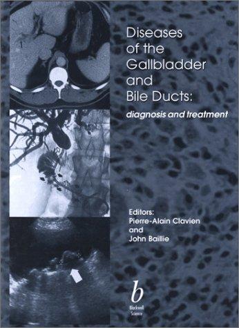 Diseases of the Gallbladder and Bile Ducts
