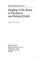 Imaging of the brain in psychiatry and related fields