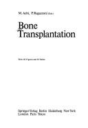 Bone Transplantation