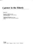 Cancer in the Elderly