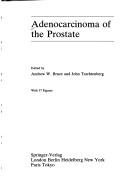 Adenocarcinoma of the Prostate